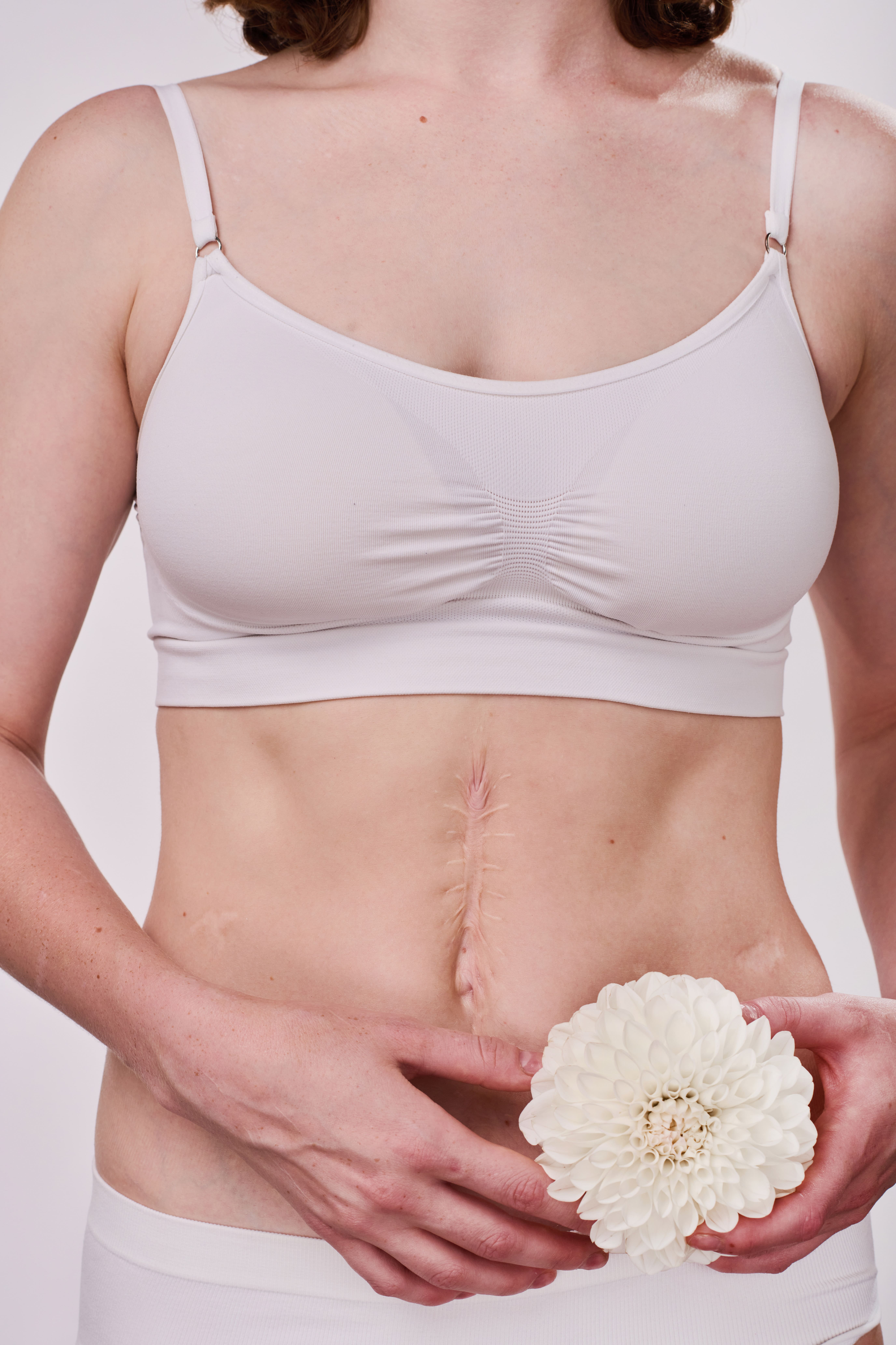 mujer con cicatriz en el abdomen sujetando una flor